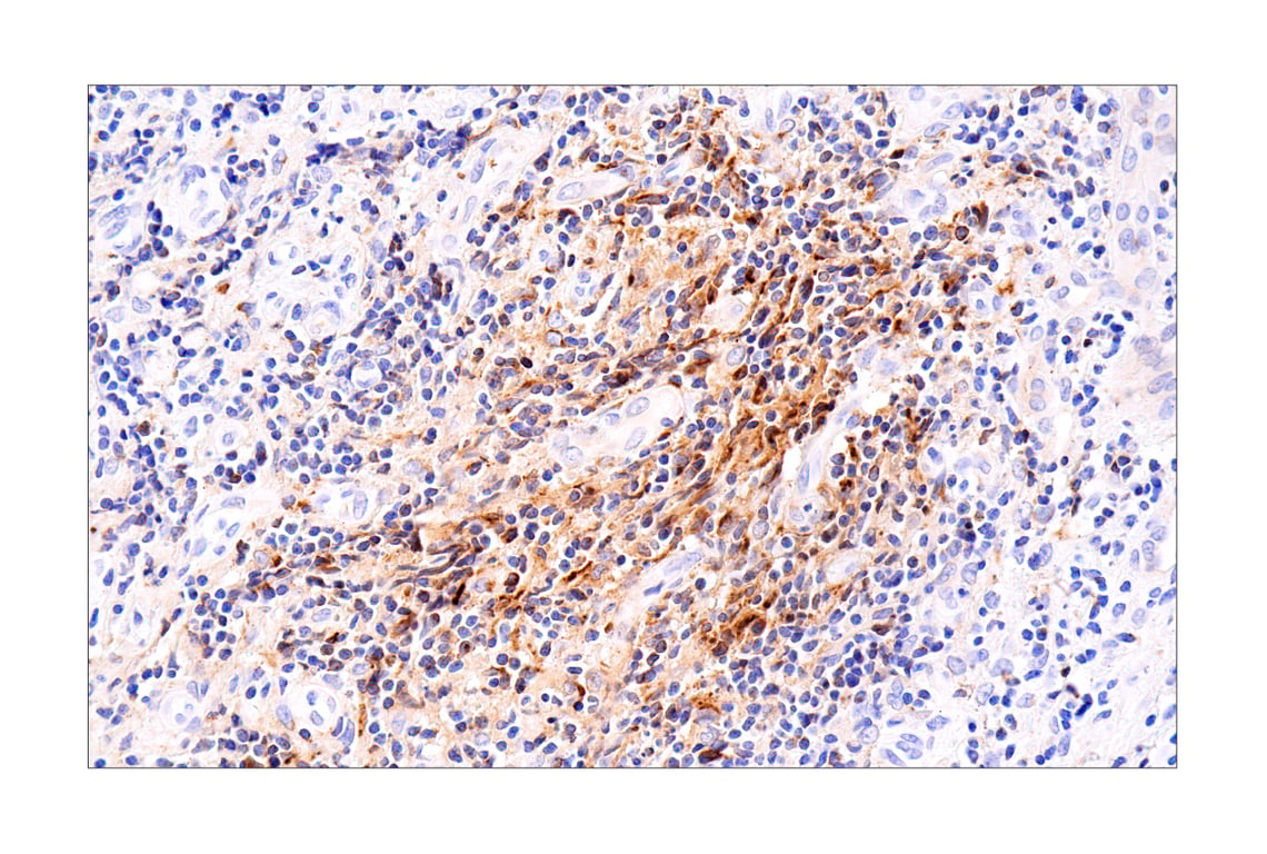 Immunohistochemistry Image 1: CXCL9/MIG (E6Z5W) Rabbit Monoclonal Antibody