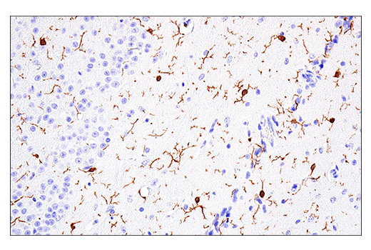Immunohistochemistry Image 4: Iba1/AIF-1 (E4O4W) Rabbit Monoclonal Antibody (BSA and Azide Free)