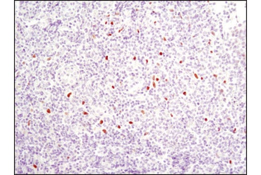 Immunohistochemistry Image 4: C/EBP alpha (D56F10) Rabbit Monoclonal Antibody (BSA and Azide Free)