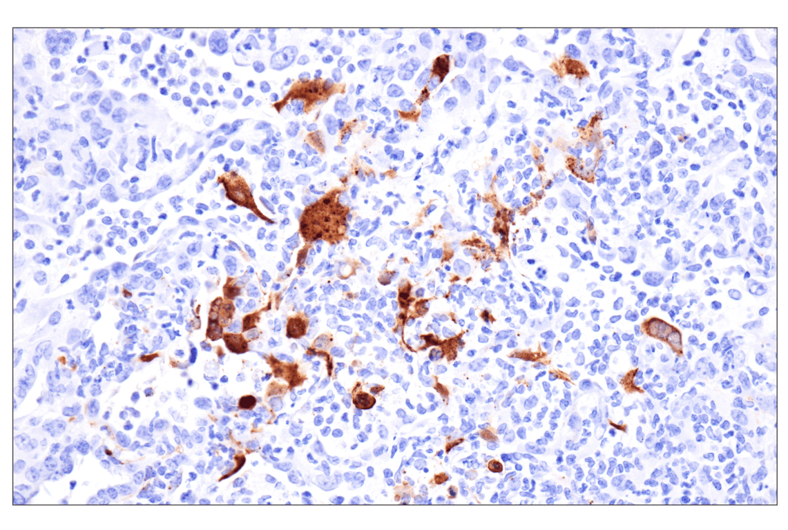 Nipah/Hendra virus Nucleocapsid (F5N9K) Rabbit Monoclonal Antibody