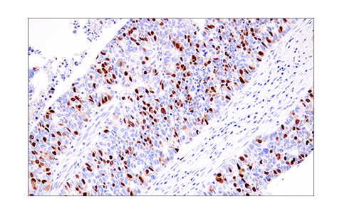 Immunohistochemistry Image 5: Geminin (E5Q9S) XP<sup>®</sup> Rabbit mAb (BSA and Azide Free)