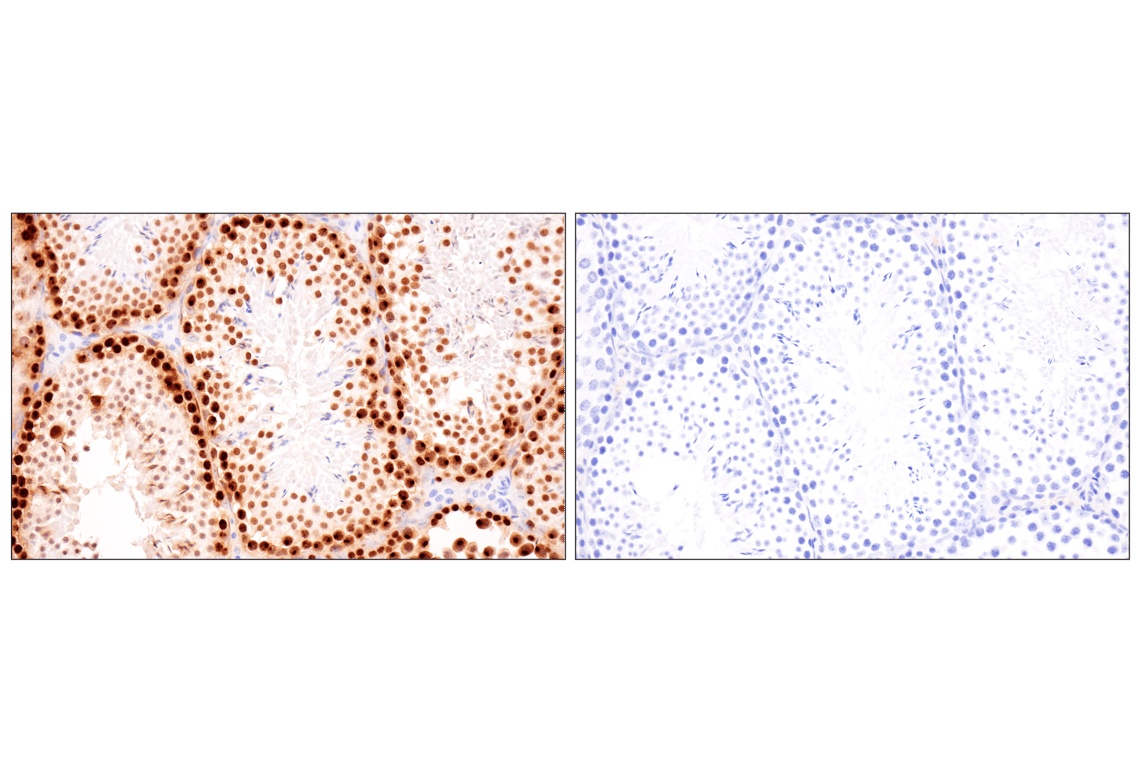 Immunohistochemistry Image 8: Phospho-Histone H2A.X (Ser139) (D7T2V) Mouse Monoclonal Antibody