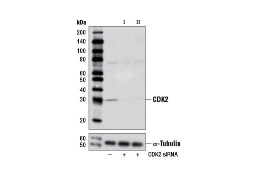 undefined Image 1: SignalSilence<sup>®</sup> CDK2 siRNA II