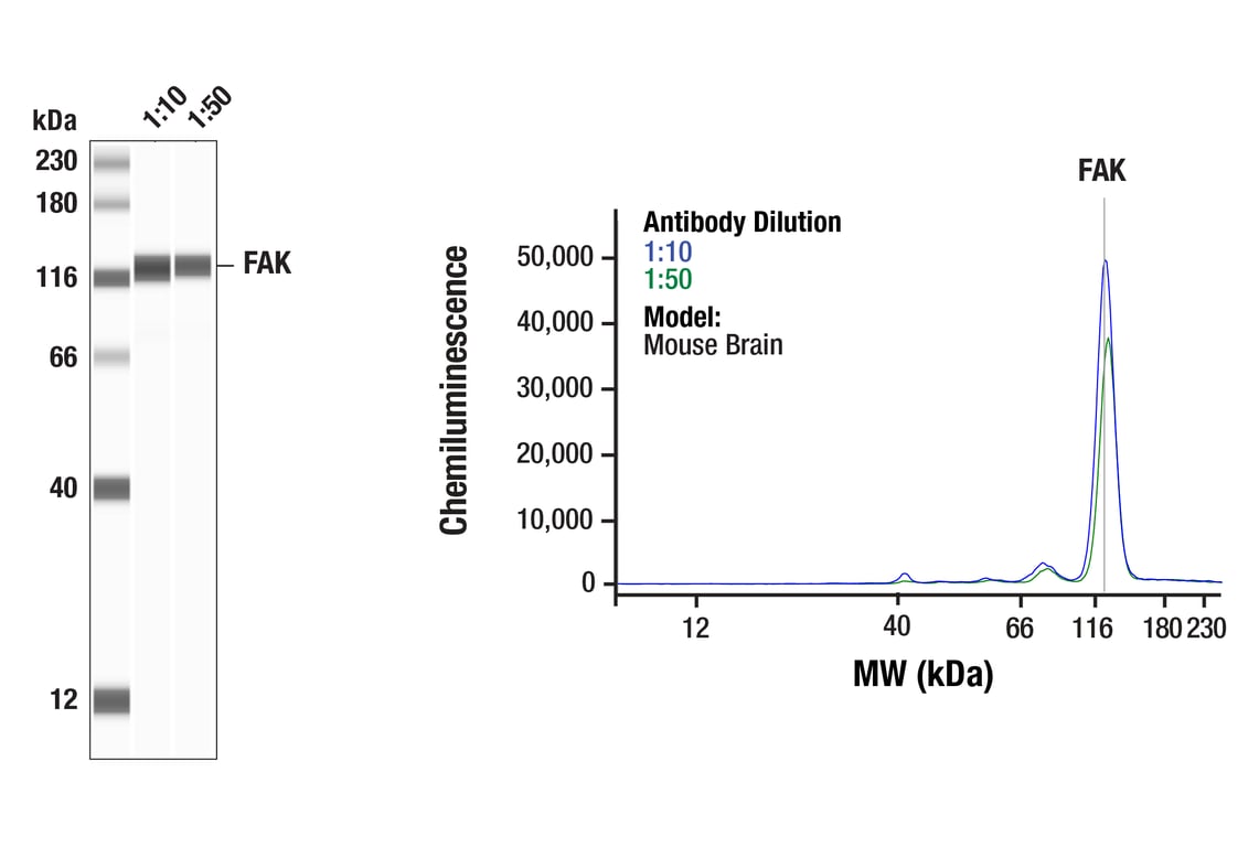 Western Blotting Image 1: FAK (F7Z4C) Mouse Monoclonal Antibody