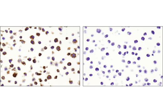 undefined Image 47: Human Reactive M1 vs M2 Macrophage IHC Antibody Sampler Kit