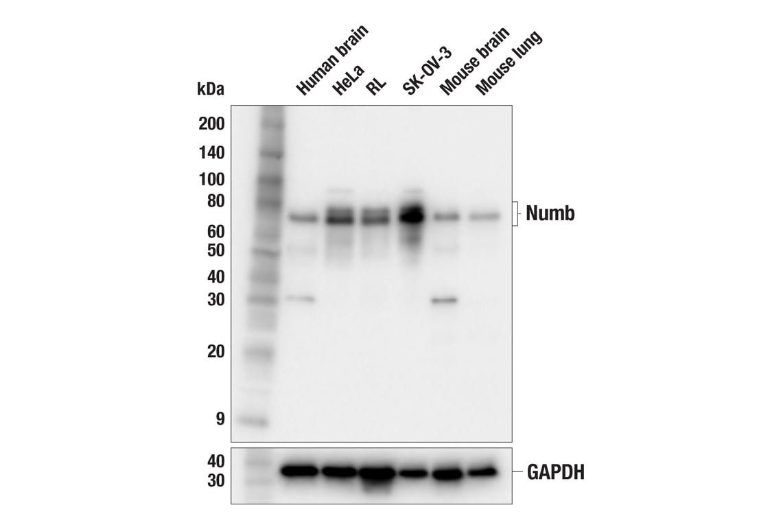 Western Blotting Image 2: Numb (F2P3P) Rabbit Monoclonal Antibody