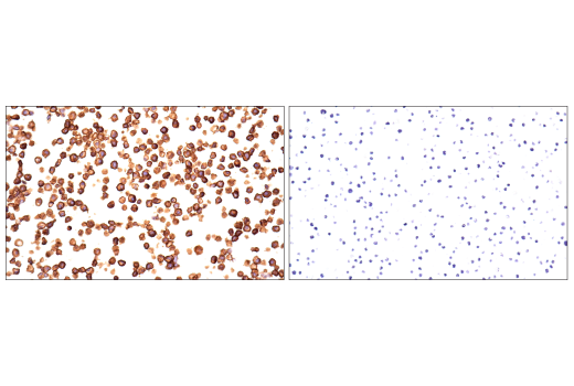Immunohistochemistry Image 4: CD86 (E5W6H) Rabbit Monoclonal Antibody (BSA and Azide Free)