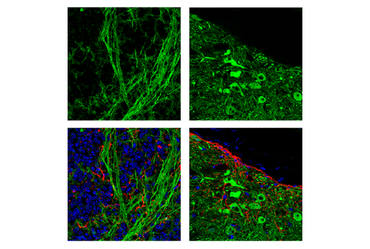 Immunofluorescence Image 3: UCHL1 (D3T2E) Rabbit Monoclonal Antibody (BSA and Azide Free)