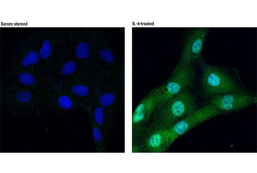 undefined Image 12: Phospho-Stat Antibody Sampler Kit