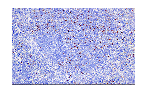Immunohistochemistry Image 5: Helios (E4L5U) Rabbit Monoclonal Antibody