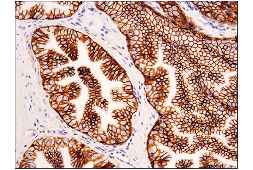 Immunohistochemistry Image 2: Catenin delta-1 (D7S2M) Rabbit Monoclonal Antibody