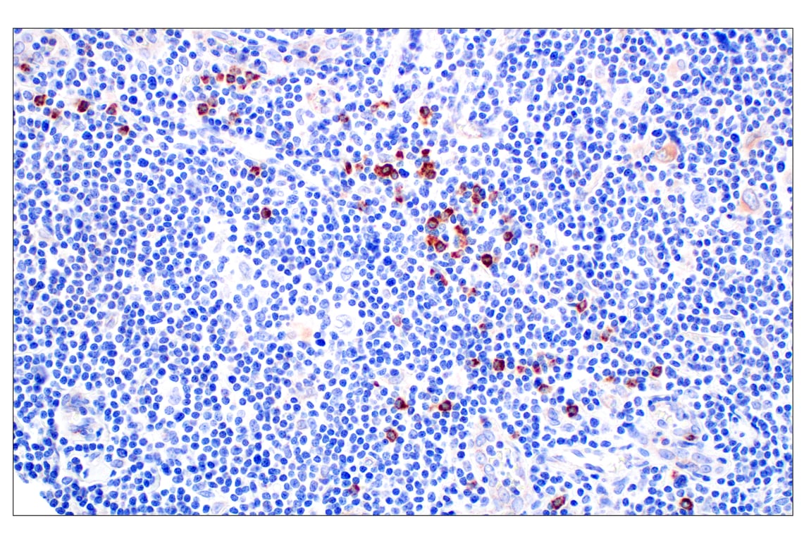 Immunohistochemistry Image 3: NPC1 (E7S4N) Rabbit Monoclonal Antibody