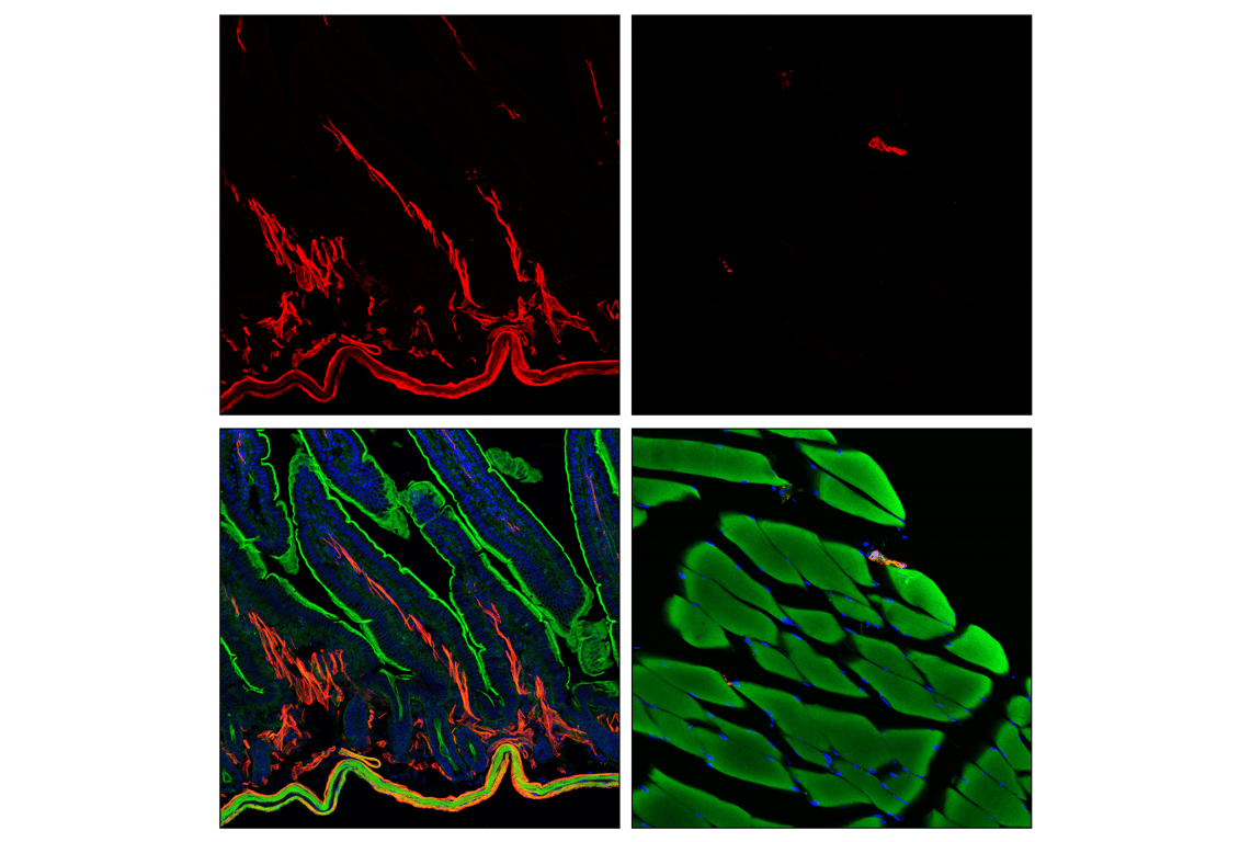 Immunofluorescence Image 1: alpha-Smooth Muscle Actin (D4K9N) Rabbit Monoclonal Antibody (Alexa Fluor<sup>®</sup> 555 Conjugate)