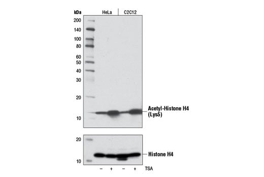Western Blotting Image 2: Acetyl-Histone H4 (Lys5) (D12B3) Rabbit Monoclonal Antibody