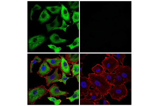 Immunofluorescence Image 1: SARS-CoV-2 Nucleocapsid Protein (E9L7H) Rabbit Monoclonal Antibody