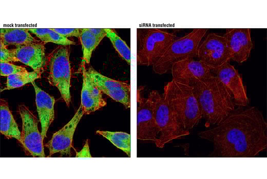 Immunofluorescence Image 1: eIF3J (D21G7) Rabbit Monoclonal Antibody