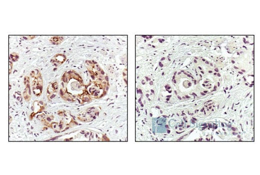 Immunohistochemistry Image 2: Phospho-EGF Receptor (Tyr1173) (53A5) Rabbit Monoclonal Antibody (BSA and Azide Free)