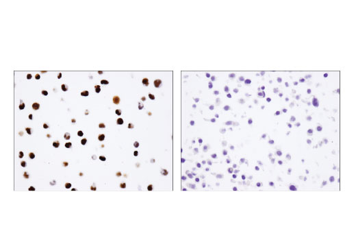 Immunohistochemistry Image 3: IFI16 (D8B5T) Rabbit Monoclonal Antibody