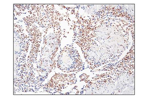 Immunohistochemistry Image 5: SS18 (D6I4Z) Rabbit Monoclonal Antibody (BSA and Azide Free)