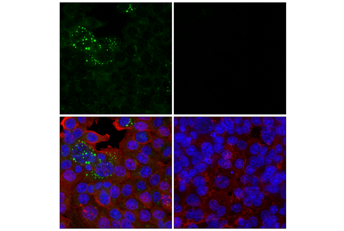 Immunofluorescence Image 2: WIPI2 (2A2) Mouse Monoclonal Antibody