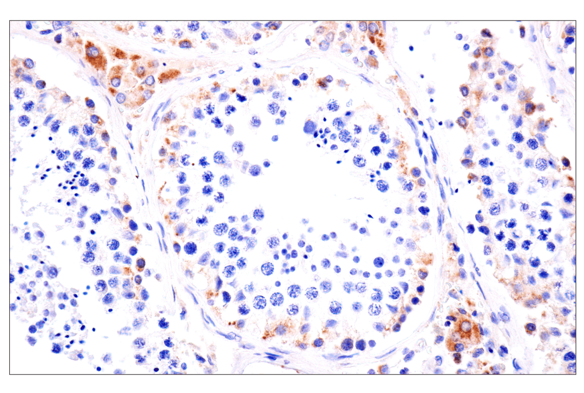 Immunohistochemistry Image 12: AMACR (F7T6V) Rabbit Monoclonal Antibody