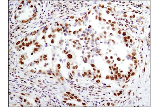 Immunohistochemistry Image 2: IFI16 (D8B5T) Rabbit Monoclonal Antibody (BSA and Azide Free)