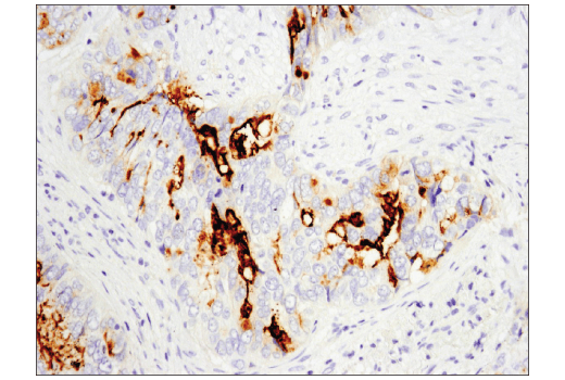 Immunohistochemistry Image 1: CD133 (D4W4N) Rabbit Monoclonal Antibody (BSA and Azide Free)
