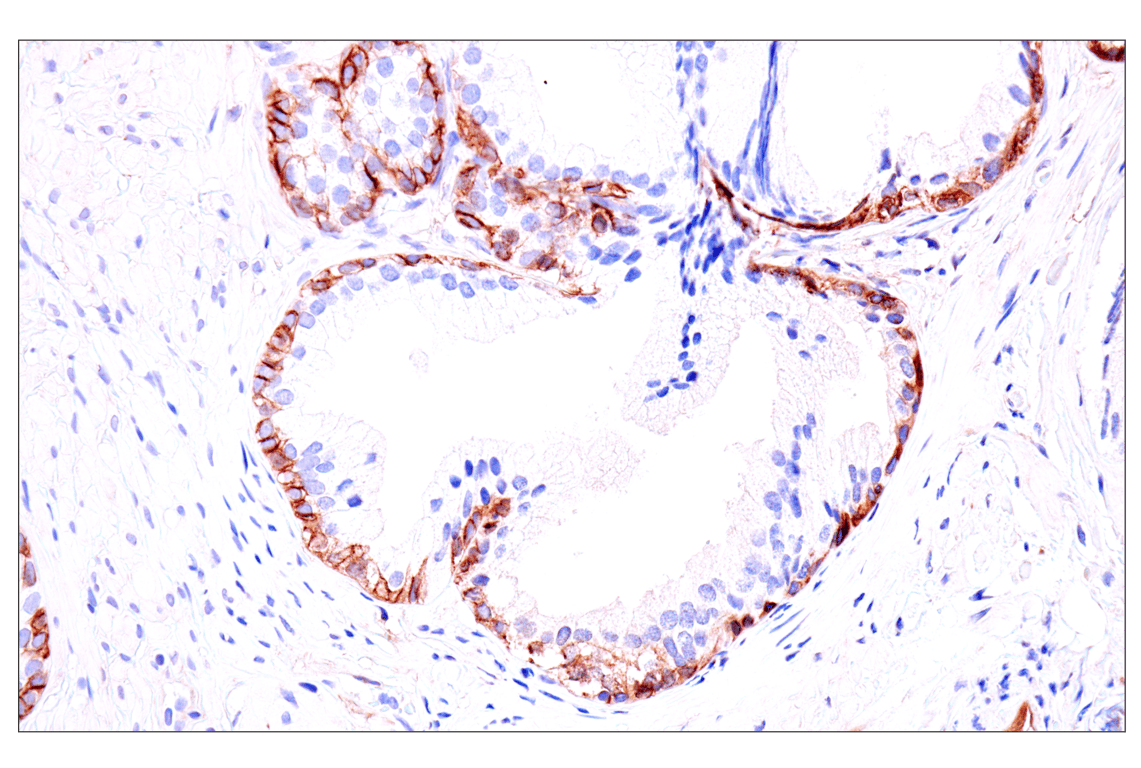 Immunohistochemistry Image 9: p75NTR (E7I3M) Rabbit Monoclonal Antibody (BSA and Azide Free)
