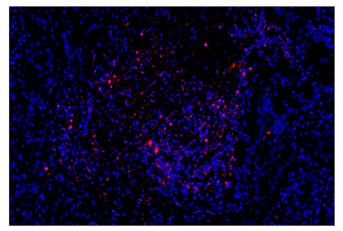 Immunohistochemistry Image 1: IL-8 (E5F5Q) & CO-0178-488 SignalStar<sup>®</sup> Oligo-Antibody Pair