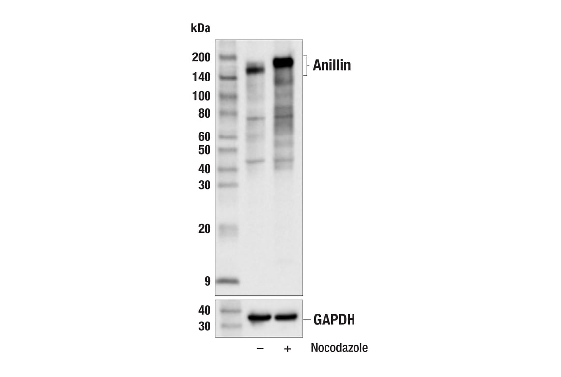 Western Blotting Image 2: Anillin (E9L6E) Rabbit Monoclonal Antibody