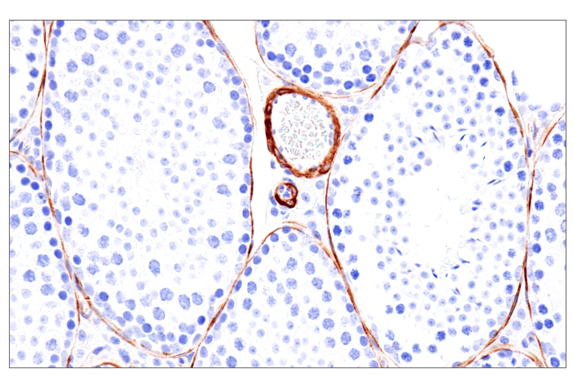 Immunohistochemistry Image 11: MYH11 (E4N8M) Rabbit Monoclonal Antibody (BSA and Azide Free)