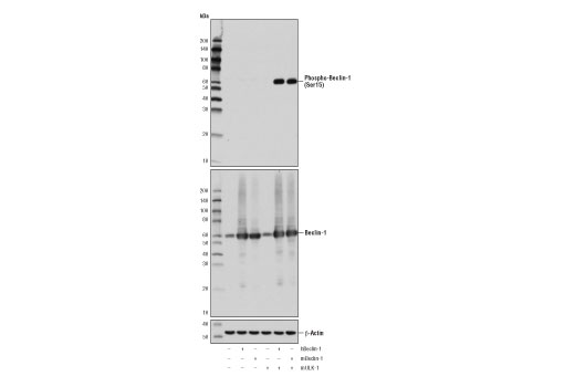 Western Blotting Image 1: Phospho-Beclin-1 (Ser15) (D4B7R) Rabbit mAb