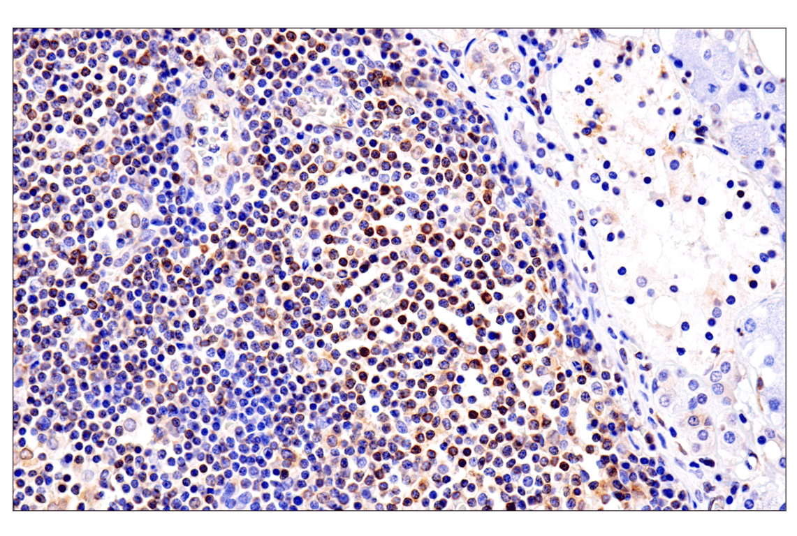 Immunohistochemistry Image 9: HLA-E (MEM-E/02) Mouse Monoclonal Antibody
