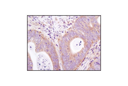 Immunohistochemistry Image 1: eIF3A (D51F4) XP<sup>®</sup> Rabbit mAb