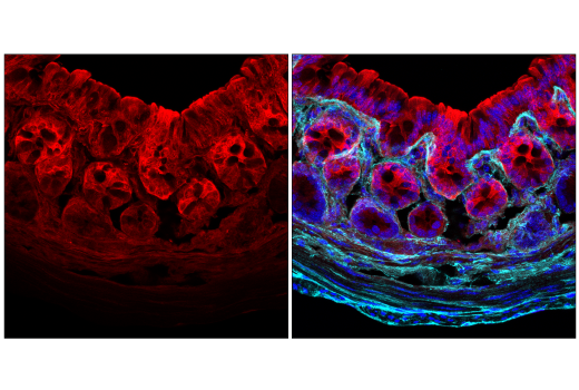 Immunofluorescence Image 1: Galectin-3/LGALS3 (E7B6R) Rabbit Monoclonal Antibody (BSA and Azide Free)