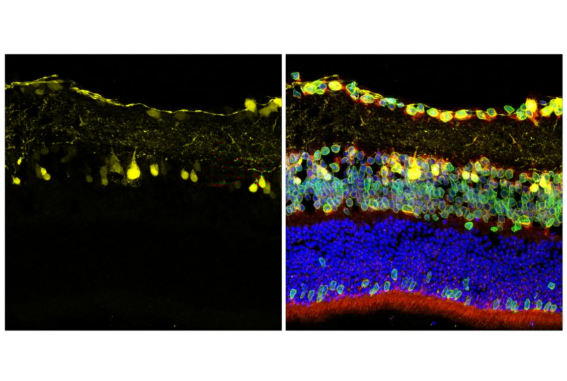 Immunofluorescence Image 2: Parvalbumin (E8N2U) Rabbit Monoclonal Antibody (BSA and Azide Free)