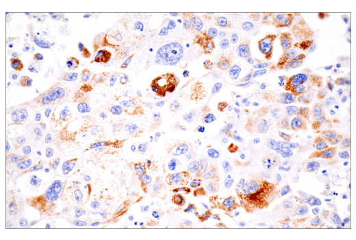Immunohistochemistry Image 3: CPS1/Hep Par-1 (E9I9U) Rabbit Monoclonal Antibody (BSA and Azide Free)