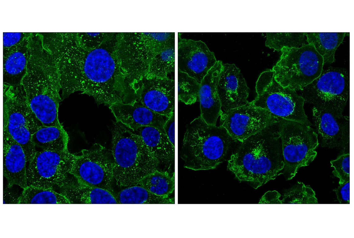 Immunofluorescence Image 1: Transferrin Receptor/CD71 (H68.4) Mouse Monoclonal Antibody