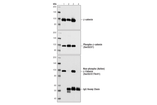 Western Blotting Image 2: Non-phospho (Active) beta-Catenin (Ser33/37/Thr41) Antibody