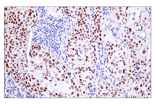 Immunohistochemistry Image 1: EED (E4L6E) Rabbit Monoclonal Antibody (BSA and Azide Free)