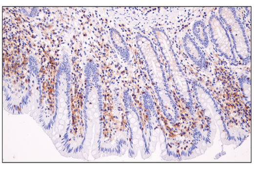 Semaphorin-4D/CD100 (E5C3B) XP® Rabbit mAb | Cell Signaling