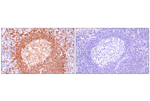 Immunohistochemistry Image 6: TNFRSF13C/BAFF-R (E3C1Q) Rabbit Monoclonal Antibody (BSA and Azide Free)