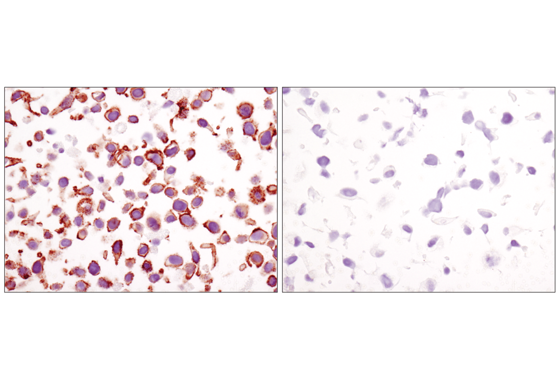 Immunohistochemistry Image 7: beta-Catenin (D10A8) Rabbit Monoclonal Antibody
