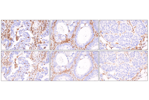 Immunohistochemistry Image 2: SLP-76 (D1R1A) Rabbit Monoclonal Antibody