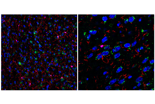 Immunofluorescence Image 1: LIMP-2/SCARB2 (E2Z5F) Rabbit Monoclonal Antibody