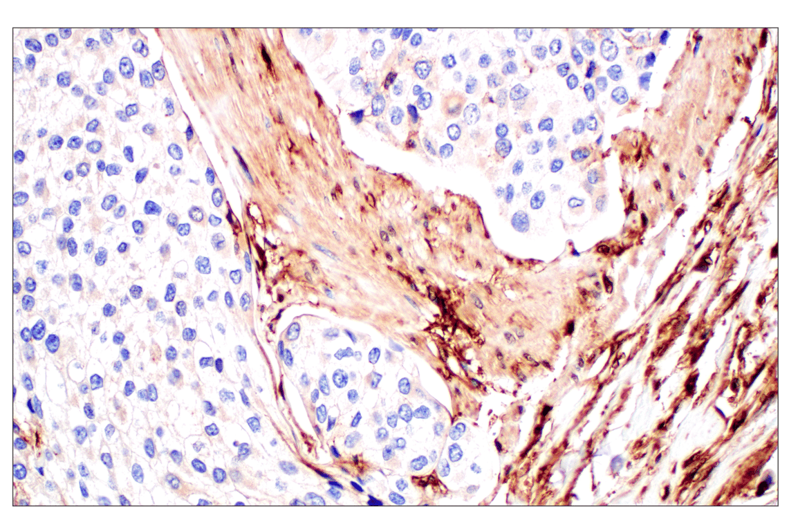 Immunohistochemistry Image 4: Annexin V (E3W8V) Rabbit Monoclonal Antibody (BSA and Azide Free)