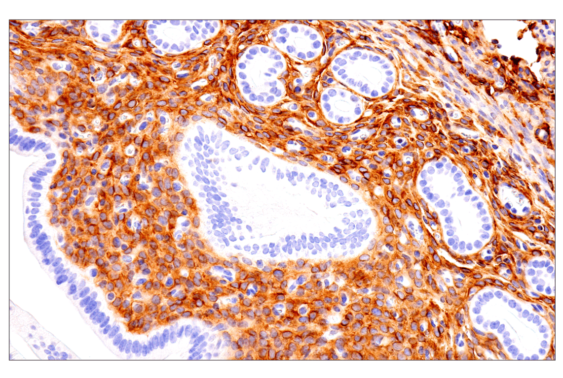 Immunohistochemistry Image 18: p75NTR (E7I3M) Rabbit Monoclonal Antibody (BSA and Azide Free)