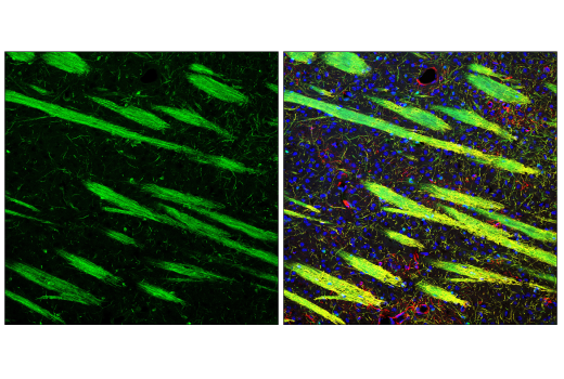 Immunofluorescence Image 3: Phospho-NDRG1 (Thr346) (D98G11) Rabbit Monoclonal Antibody