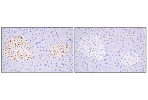 Immunohistochemistry Image 6: Cyclin D1 (E3P5S) Rabbit Monoclonal Antibody (BSA and Azide Free)