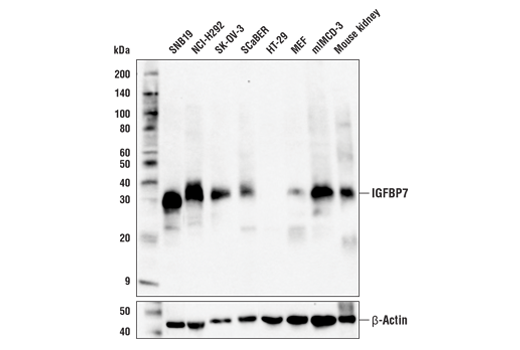 Western Blotting Image 1: IGFBP7 (E8R2V) Rabbit mAb